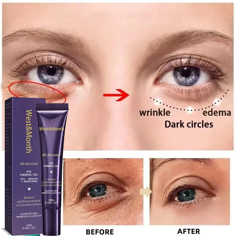 Retinol Eye Gel Cream For Dark Circles And Puffiness
