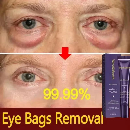 Retinol Eye Gel Cream For Dark Circles And Puffiness