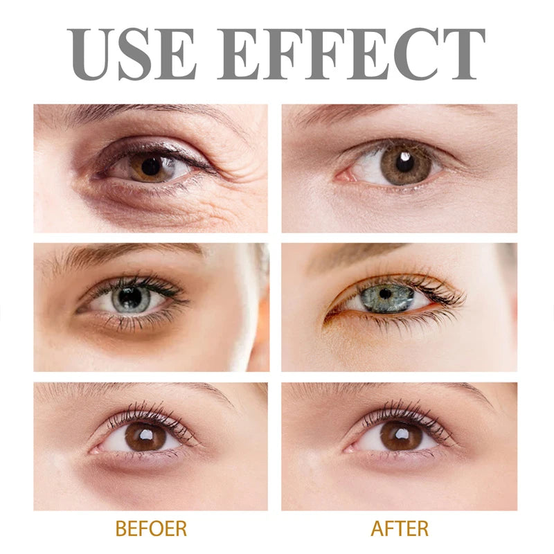 Retinol Eye Gel Cream For Dark Circles And Puffiness